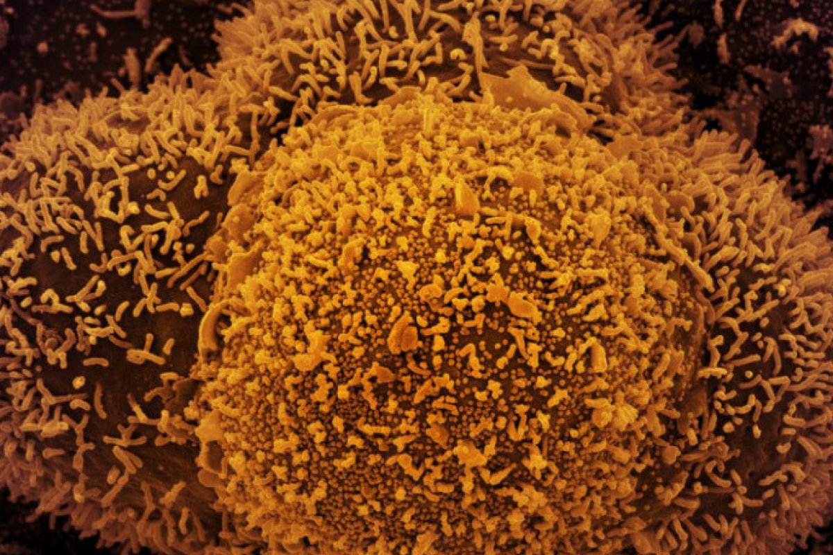 Covid-19: Brasil atinge 27,4 milhões de casos e 638.048 óbitos