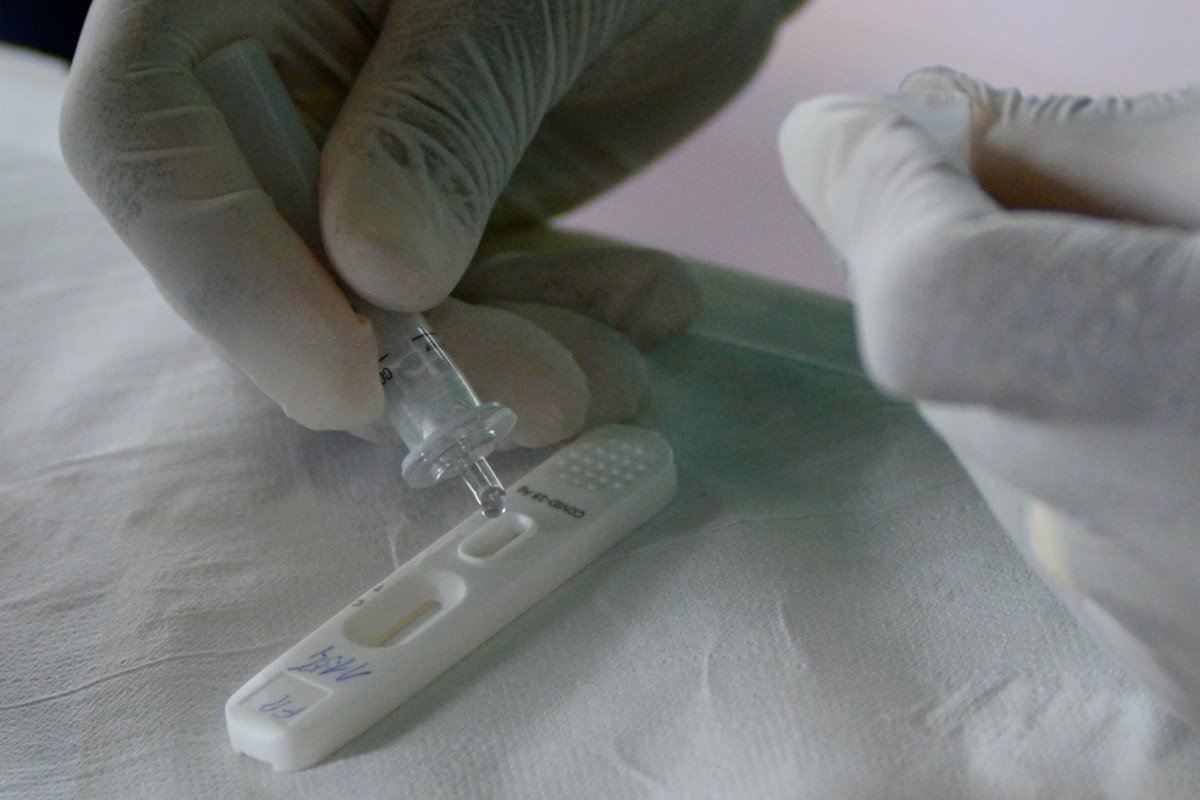 Anvisa aprova registro de segundo autoteste para Covid-19 no Brasil