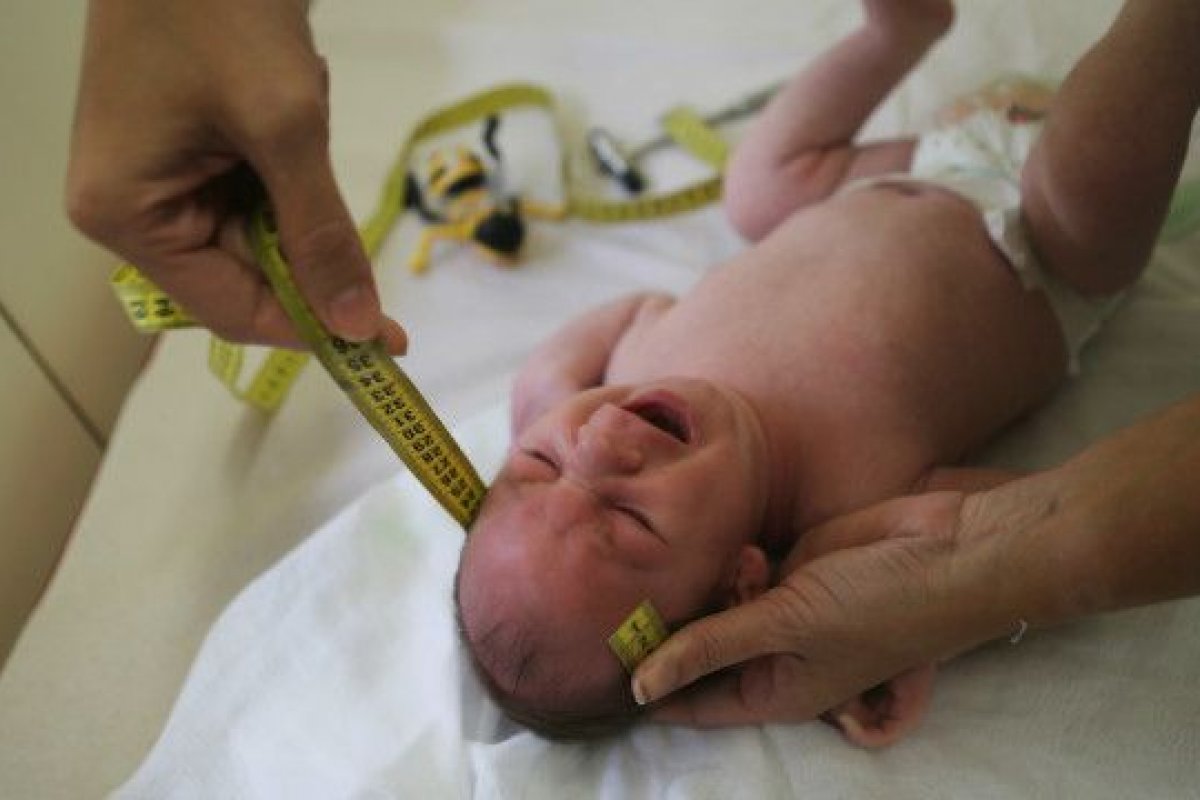 Crianças com Síndrome Congênita da Zika tem pior risco de morte, aponta Fiocruz