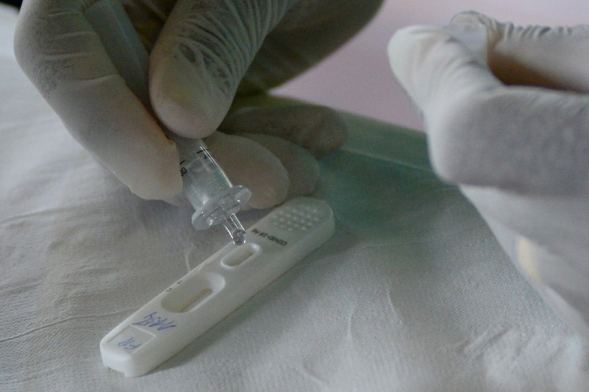 Anvisa aprova mais dois autotestes de Covid-19 no Brasil