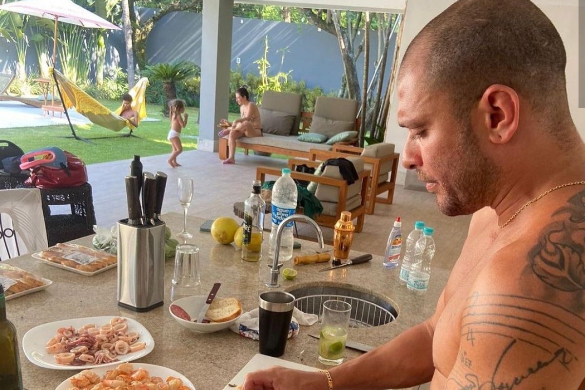 Diogo Nogueira inicia o processo de transplante capilar!