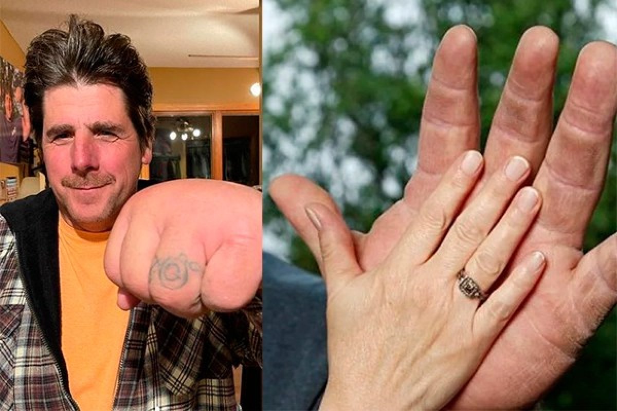 Homem com braços e mãos gigantes viraliza na internet