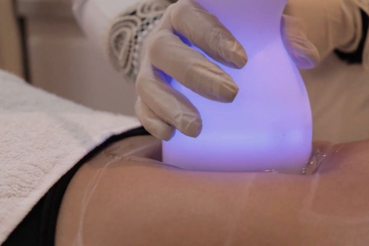 Fique por dentro do Slim Effect, método estético com resultado imediato na perda de peso e medidas