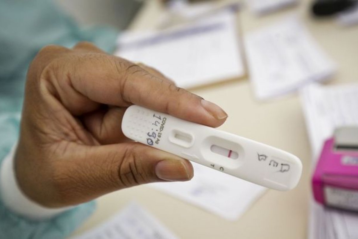 Testes rápidos positivos para Covid-19 em farmácia caem mais de 64%