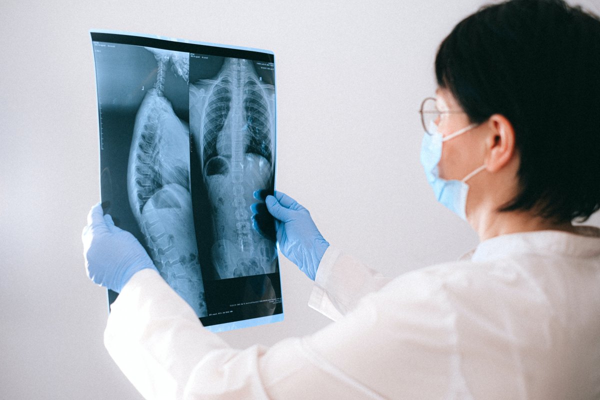 Em 2021, Brasil registrou mais de 68 mil novos casos de tuberculose