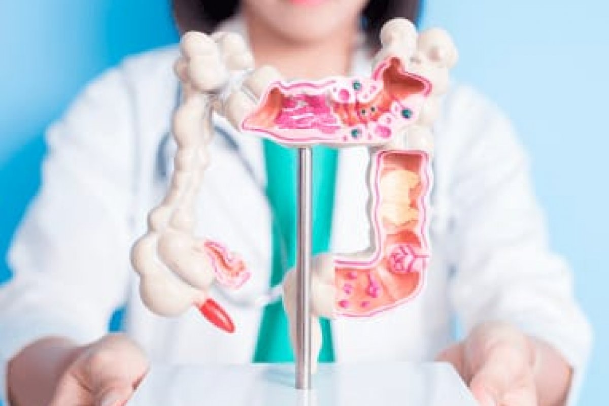 Inca estima 40,9 mil novos casos de câncer colorretal no Brasil este ano