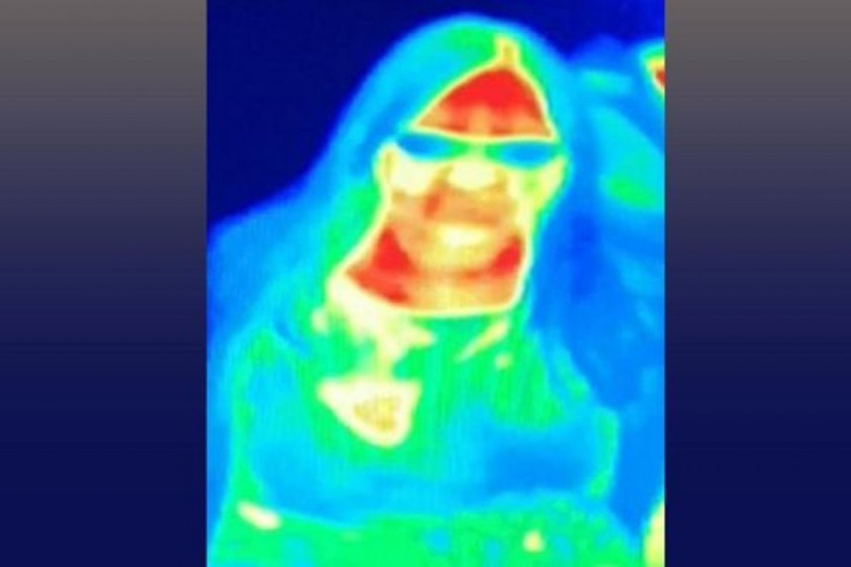 Câmera identifica mulher com câncer de mama na Europa