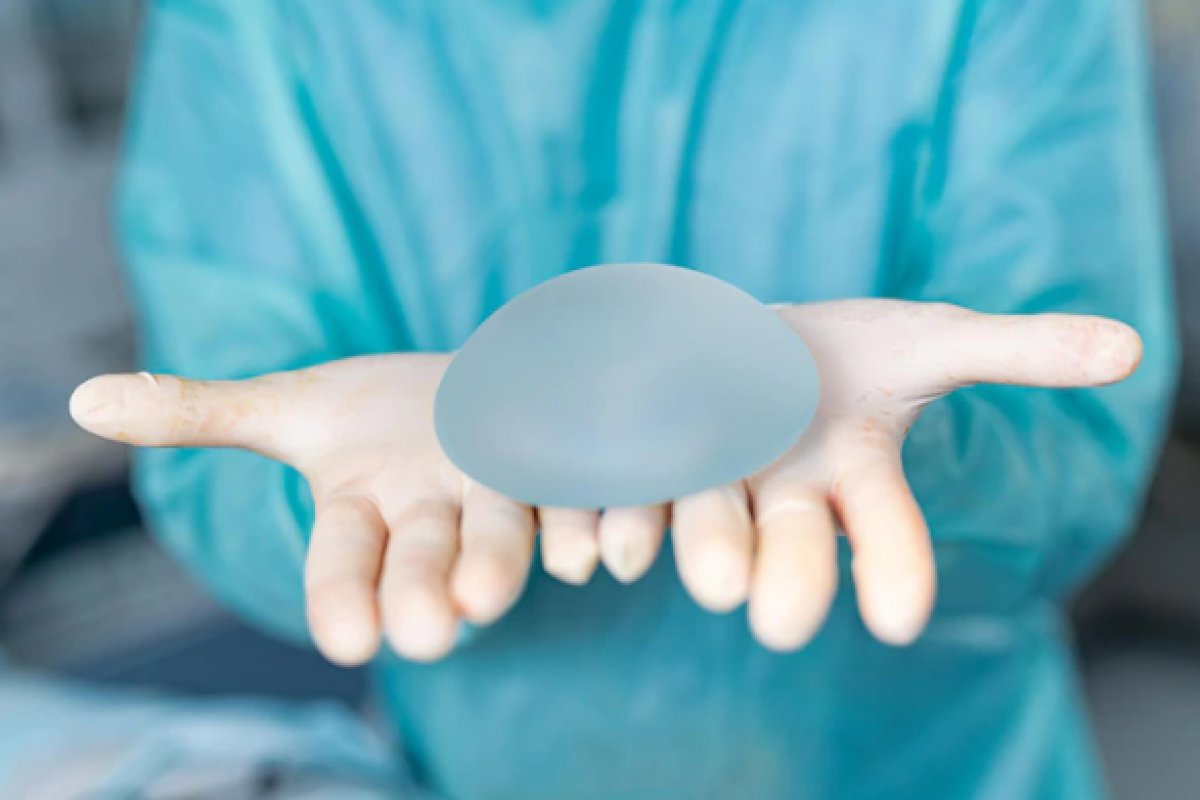 Levantamento indica alta em procura por retirada de implantes de silicone