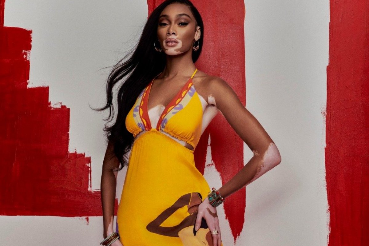 Colcci convida a top model Winnie Harlow para ser musa do Camarote N1, na Sapucaí