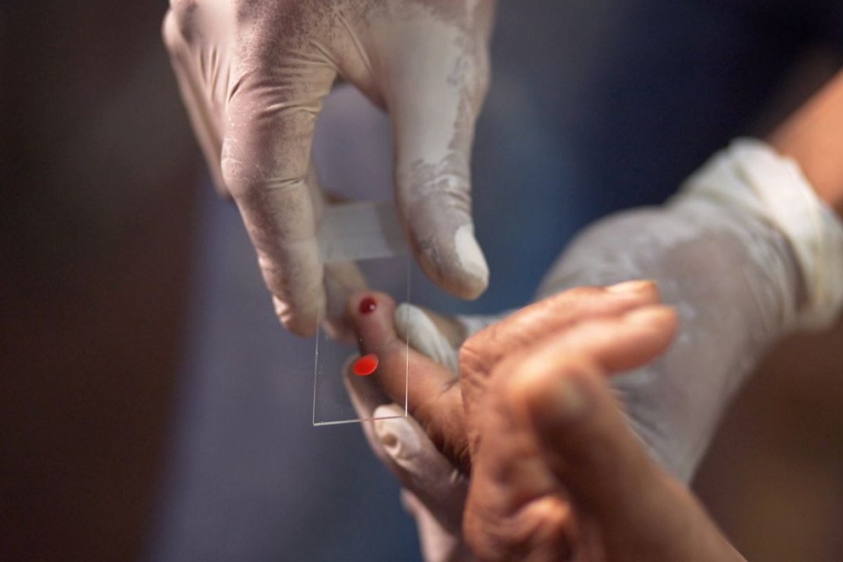 Brasil pretende zerar casos de malária até 2035