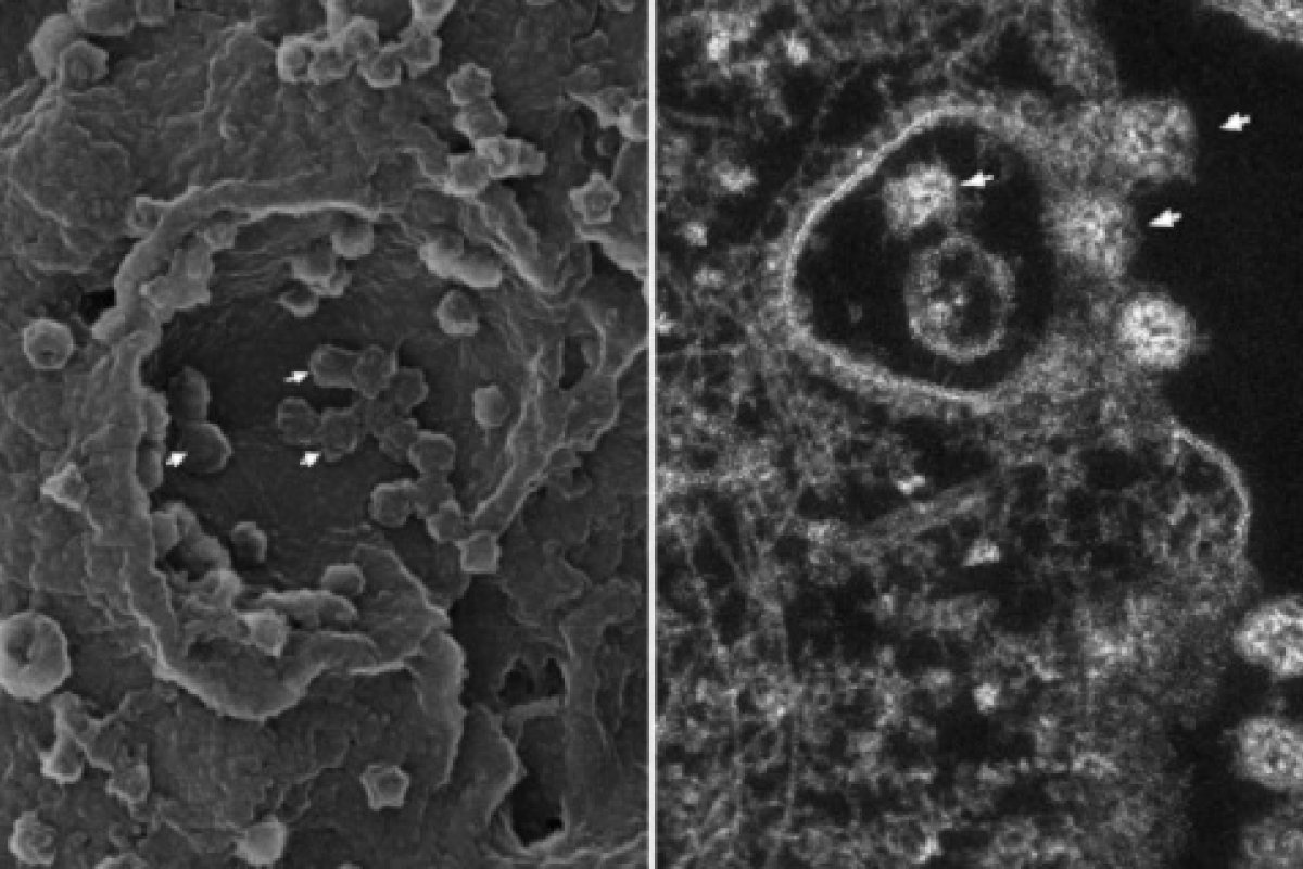 Pesquisadores revelam em estudo o processo de infecção celular pelo coronavírus