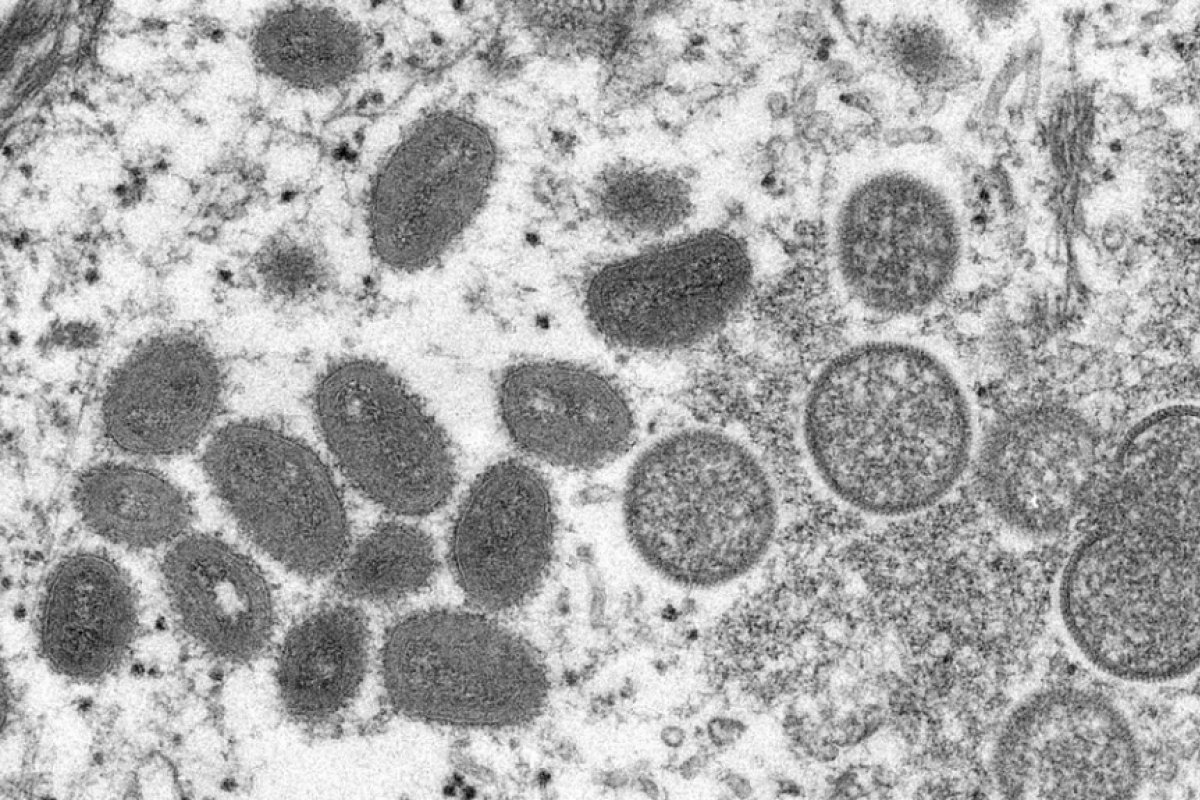 OMS: transmissão da varíola do macaco pode ser contida nos países não endêmicos
