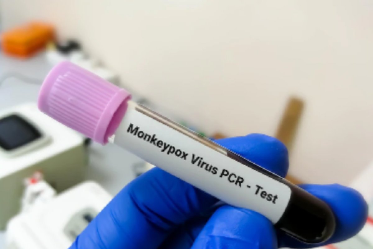 Bahia e outros três estados aumentam nível de alerta para varíola em macacos