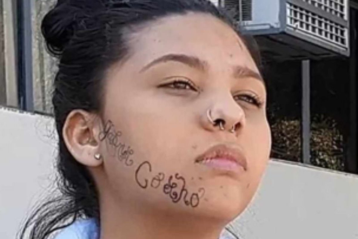 Jovem que teve rosto tatuado pelo ex-namorado inicia sessões de remoção: 'Me sinto livre'