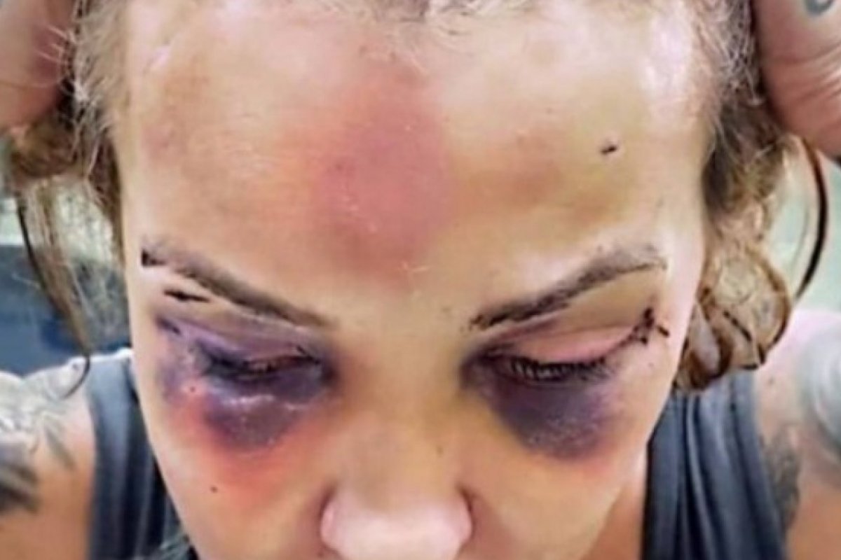 Jornalista torturada pelo ex-namorado volta a receber ameaças