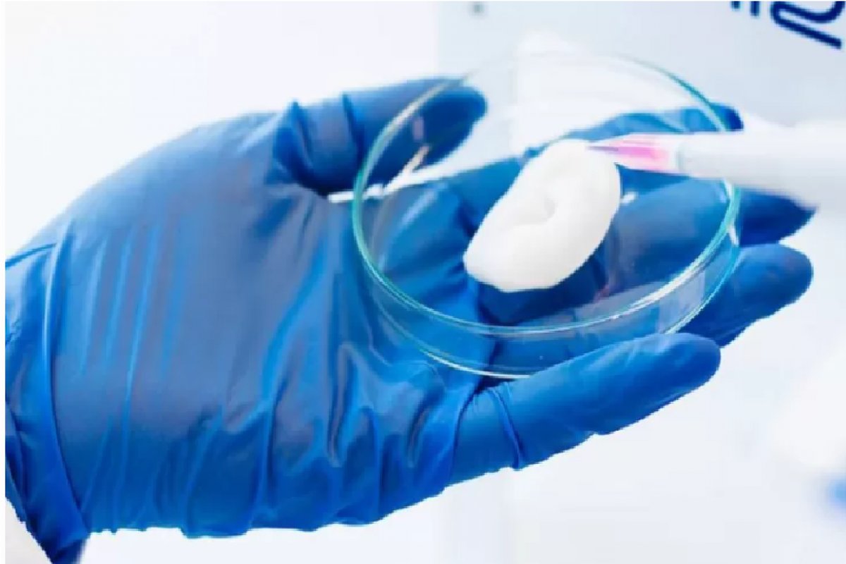 Médicos transplantam orelha impressa em 3D feita de células humanas