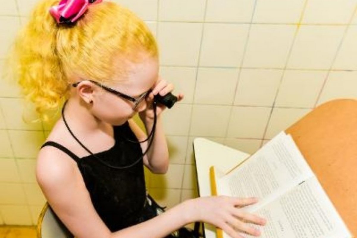 Pessoas com albinismo têm dia especial de atendimento no Instituto de Cegos da Bahia