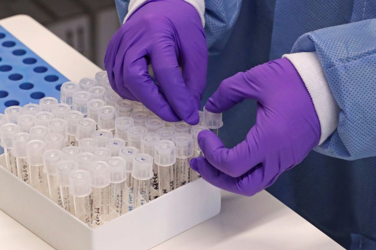 Covid-19: Taxa de testes positivos sobe 326% em farmácias