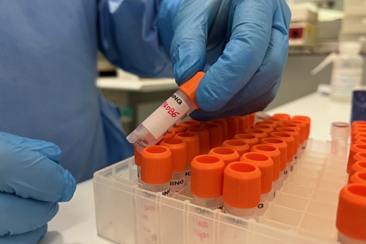 Profissionais da saúde de sete países recebem treinamento para diagnóstico da varíola no Brasil