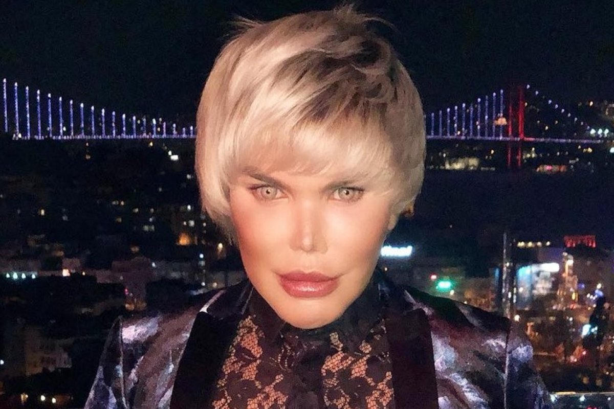 Ken Humano brasileiro se prepara para mais três cirurgias