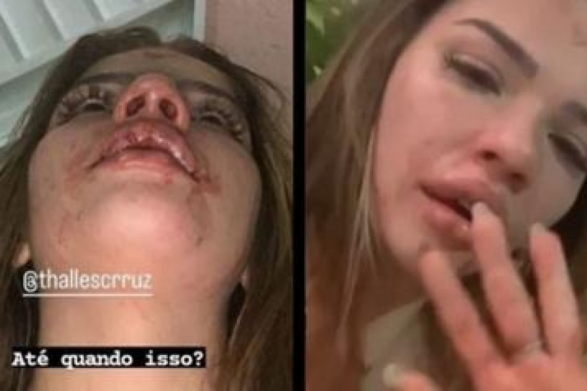 Vídeo: Influencer acusa namorado de agressão: 'porque eu não queria namorar'