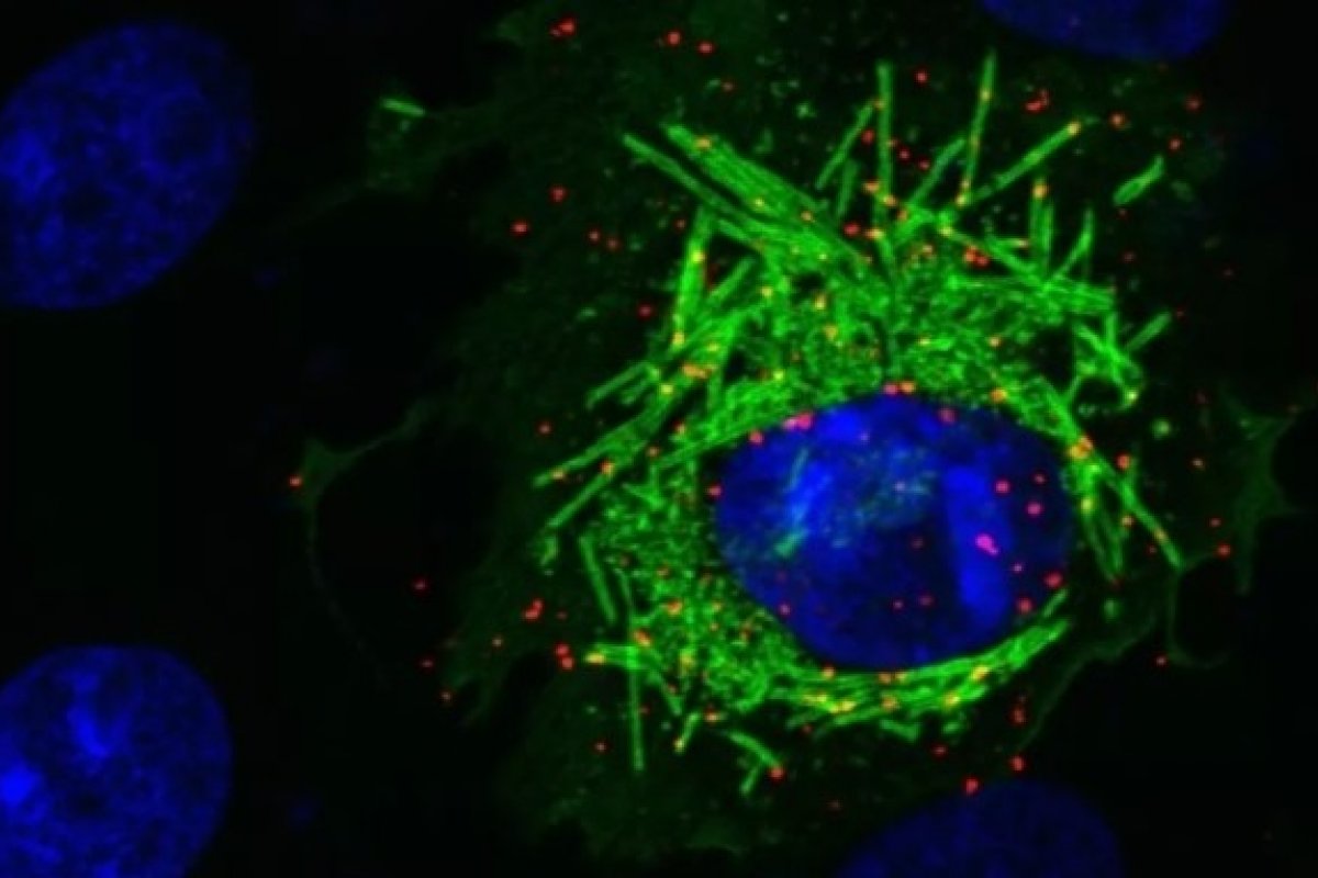 Covid-19: estudo revela que vírus manipula as células para se replicar