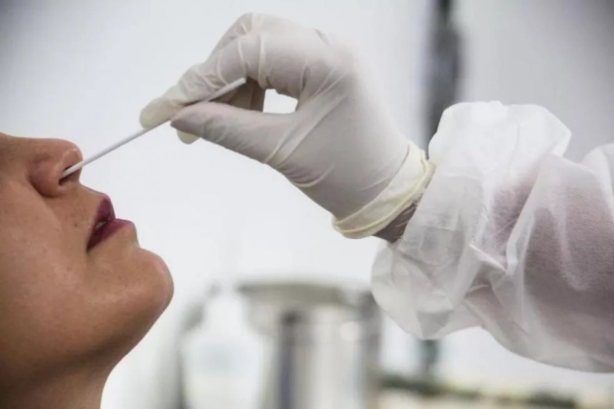 Mulheres e pessoas entre 50 e 60 anos têm mais chance de ter Covid longa