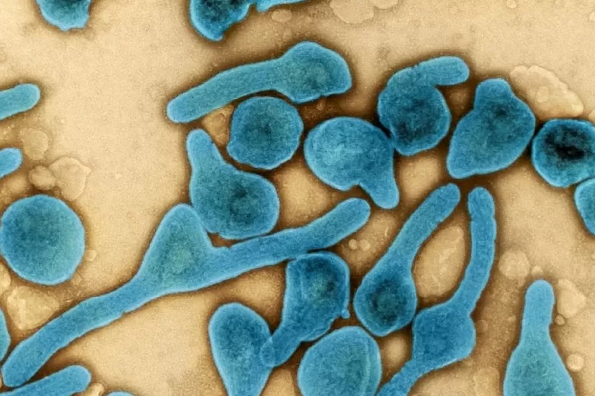 Duas pessoas morrem na África após contaminação por vírus de Marburg
