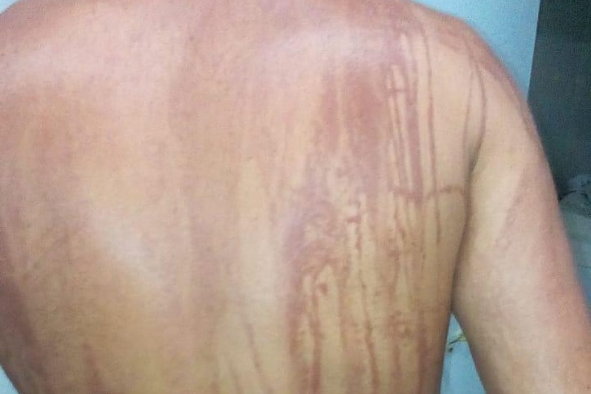 Secretaria de Saúde de Ilhéus nega intoxicação por óleo em turista de Minas Gerais