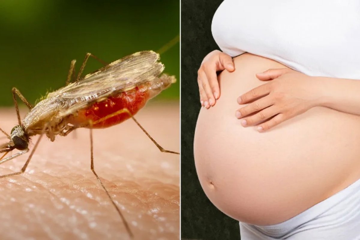 Pesquisa da USP aponta queda na incidência de malária gestacional no Brasil