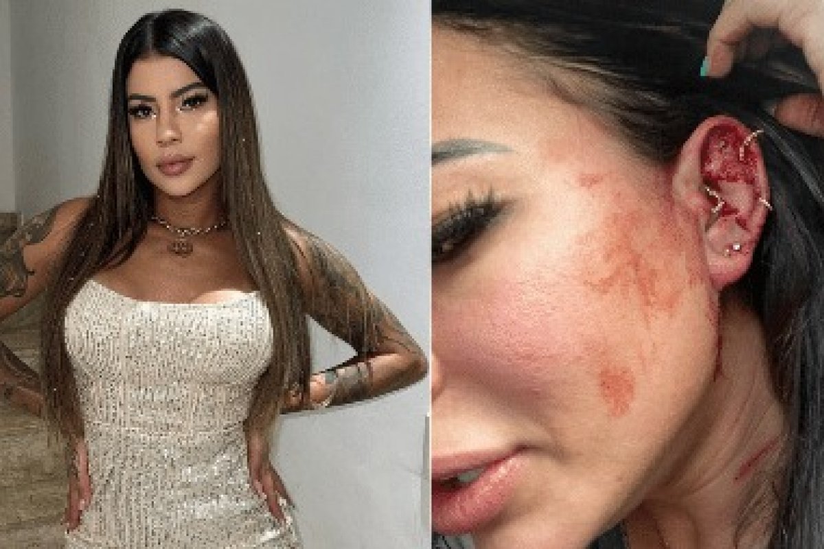 Influencer Milena Lins denuncia agressão de namorado na web