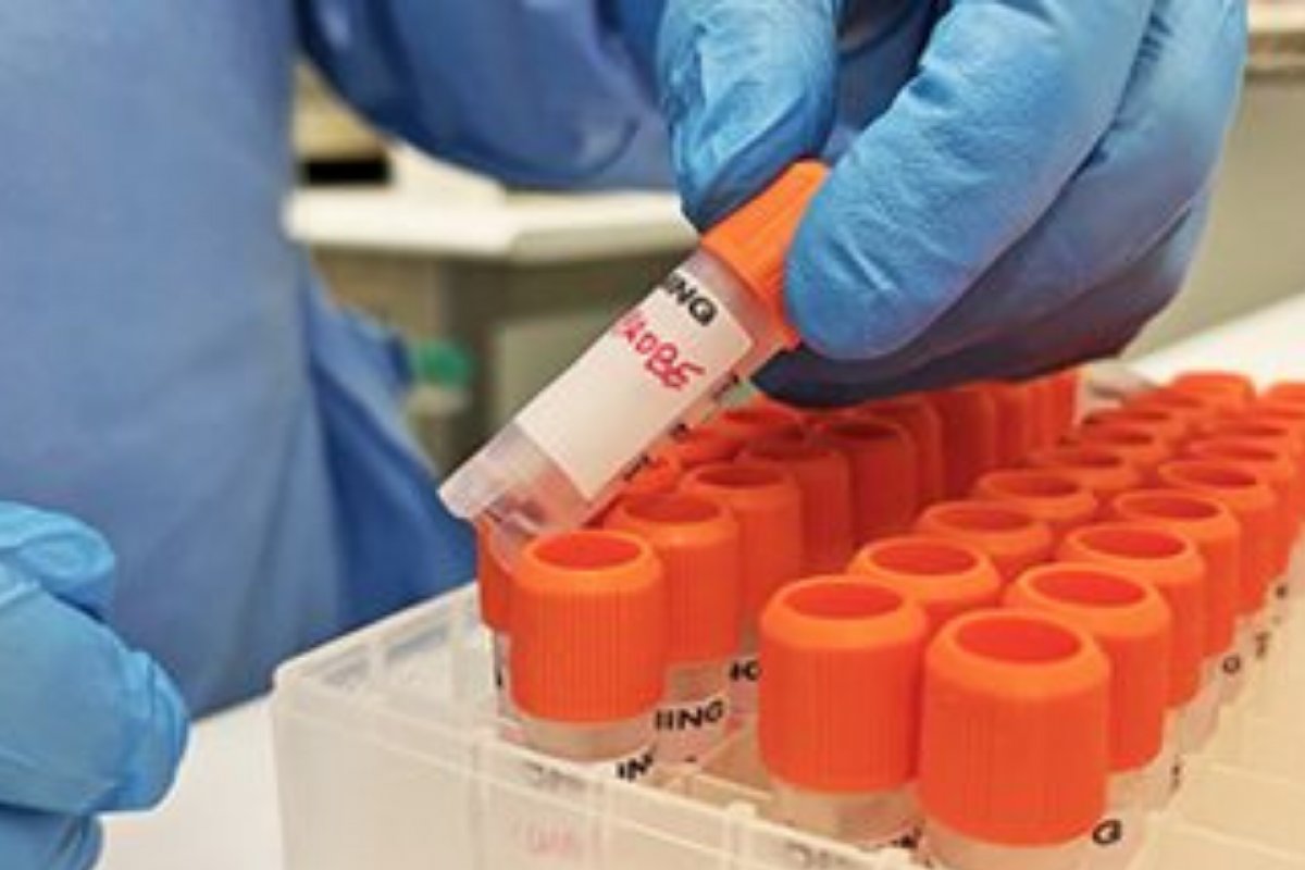 Salvador registra mais dois casos de Monkeypox