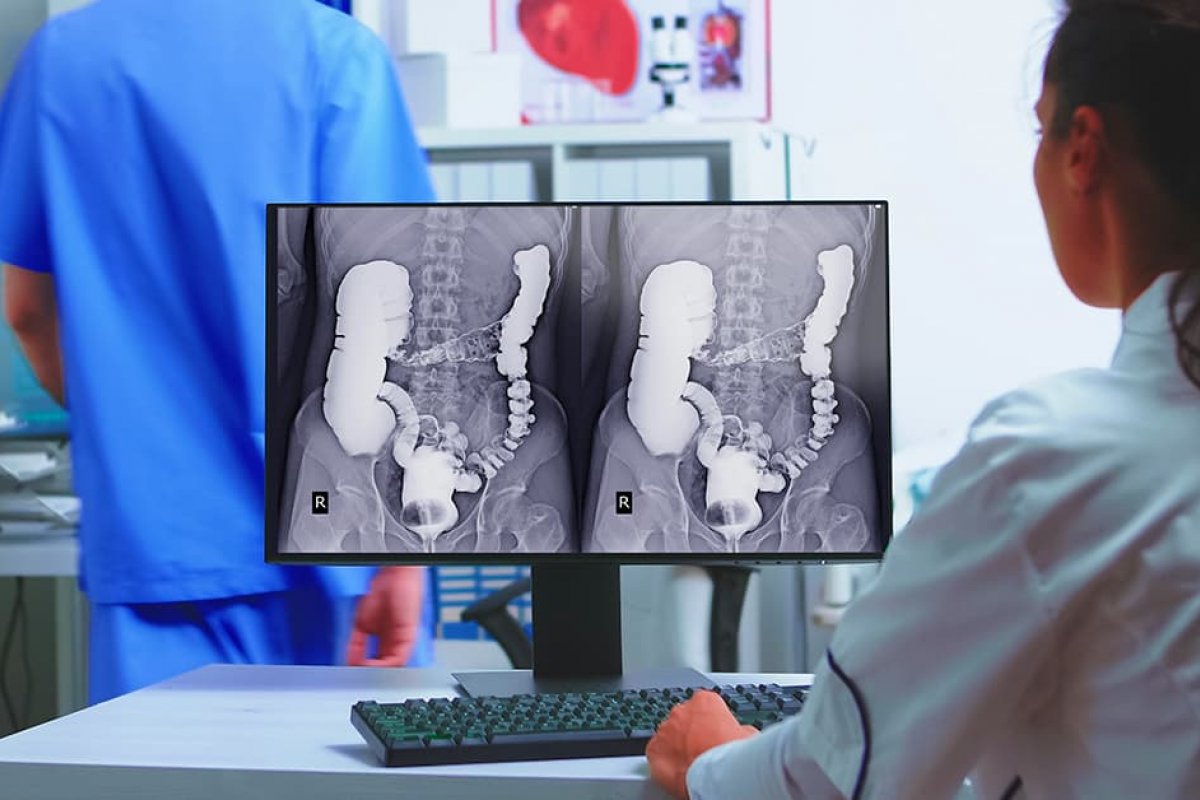 Ministério da Saúde orienta racionalizar contraste para exames após escassez global