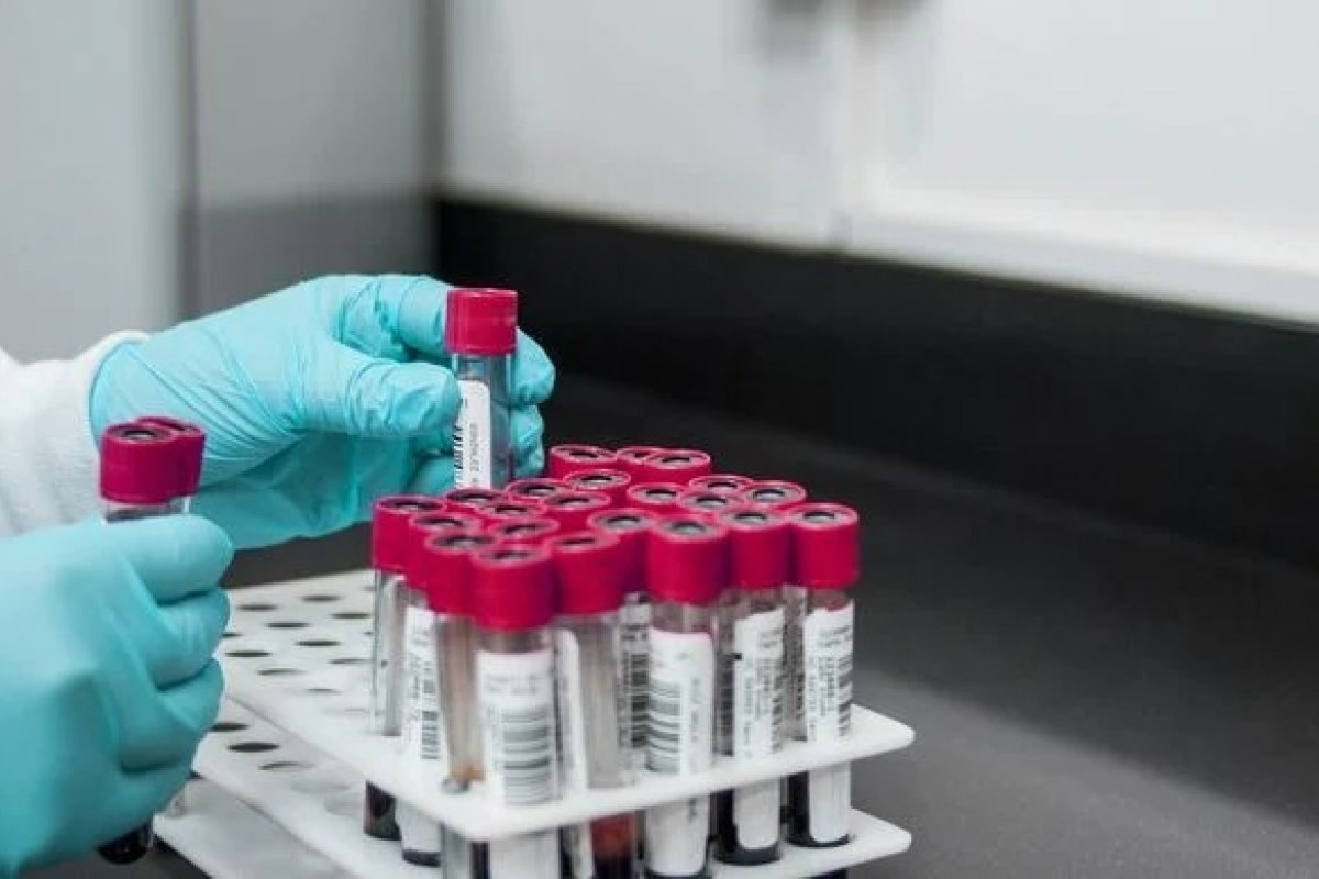 Hepatite misteriosa: surto em crianças pode ser provocado por vírus comum