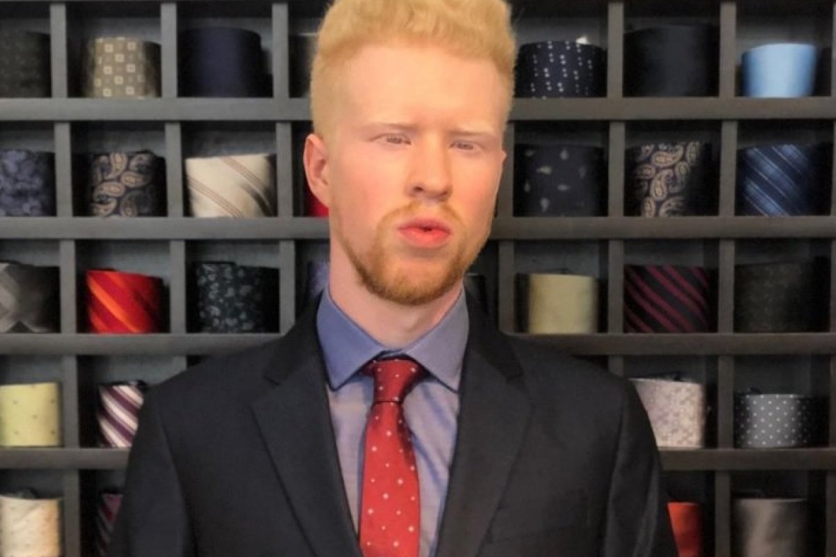 Modelo Italo Ravelle, de Joinville, conquista mundo da moda ao dar visibilidade ao albinismo!