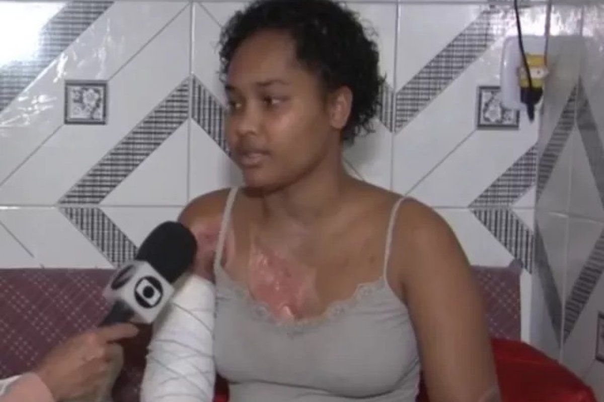 Jovem pede ajuda após ter corpo queimado enquanto cozinhava com álcool