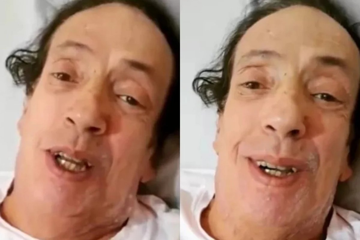 Marcos Oliveira, Beiçola da 'Grande Família', se recupera de cirurgia e pede doações