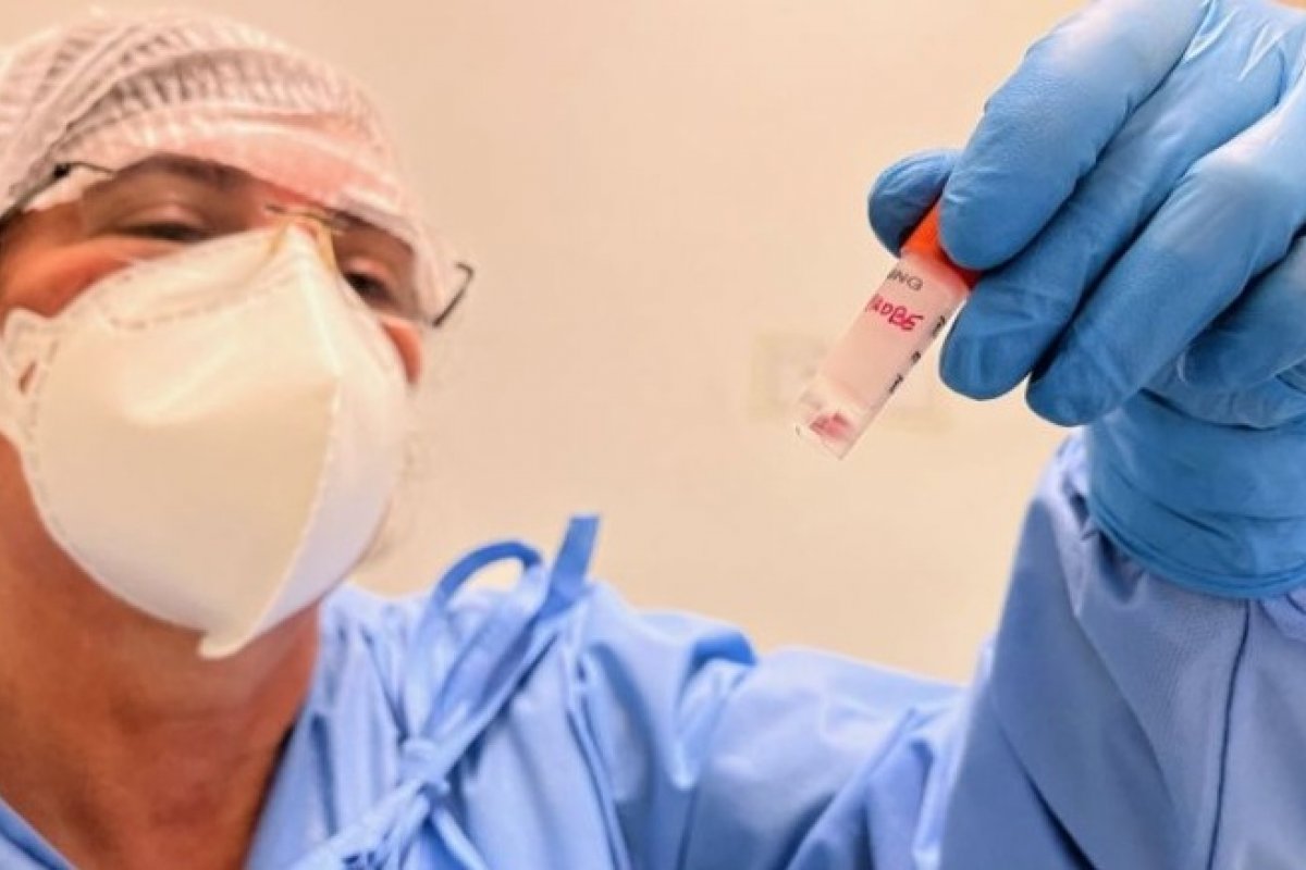 Gerente da Anvisa diz que combate à varíola dos macacos é mais 'cômoda' que a do coronavírus