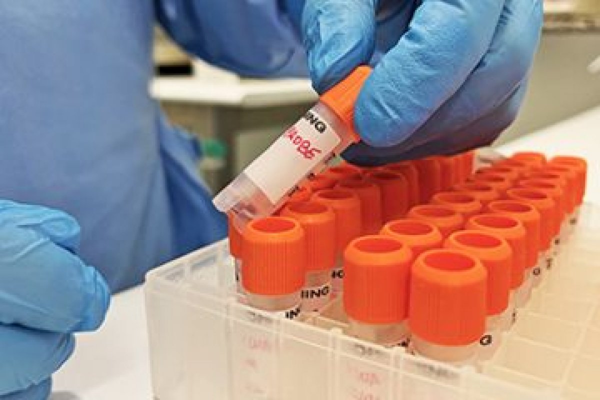 Salvador registra mais dois casos de varíola dos macacos