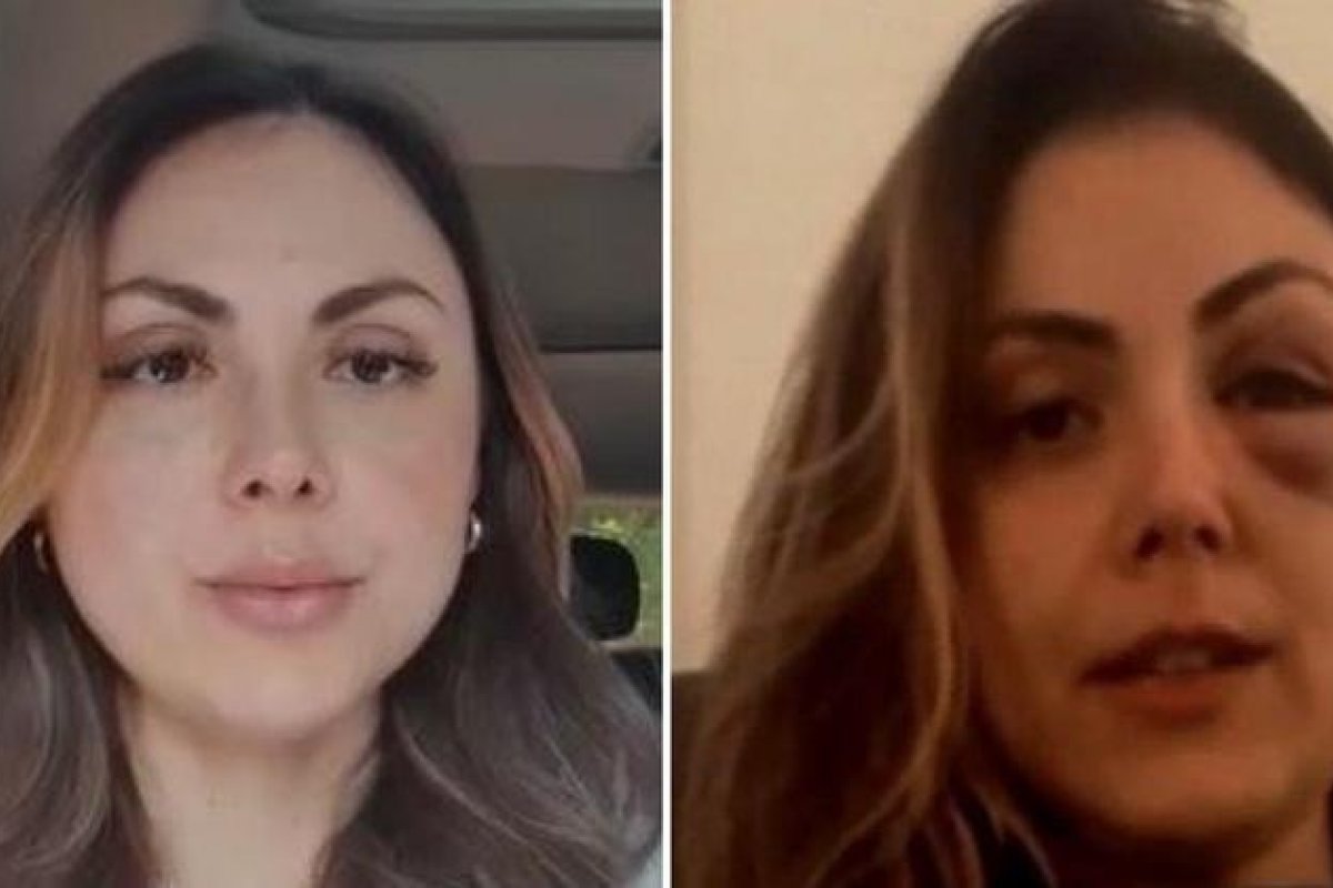 Procuradora espancada por colega deve retornar às atividades nesta segunda-feira