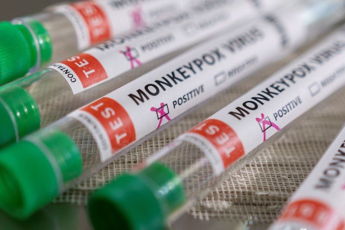 Varíola dos Macacos pode ser encontrada no sêmen, diz pesquisa