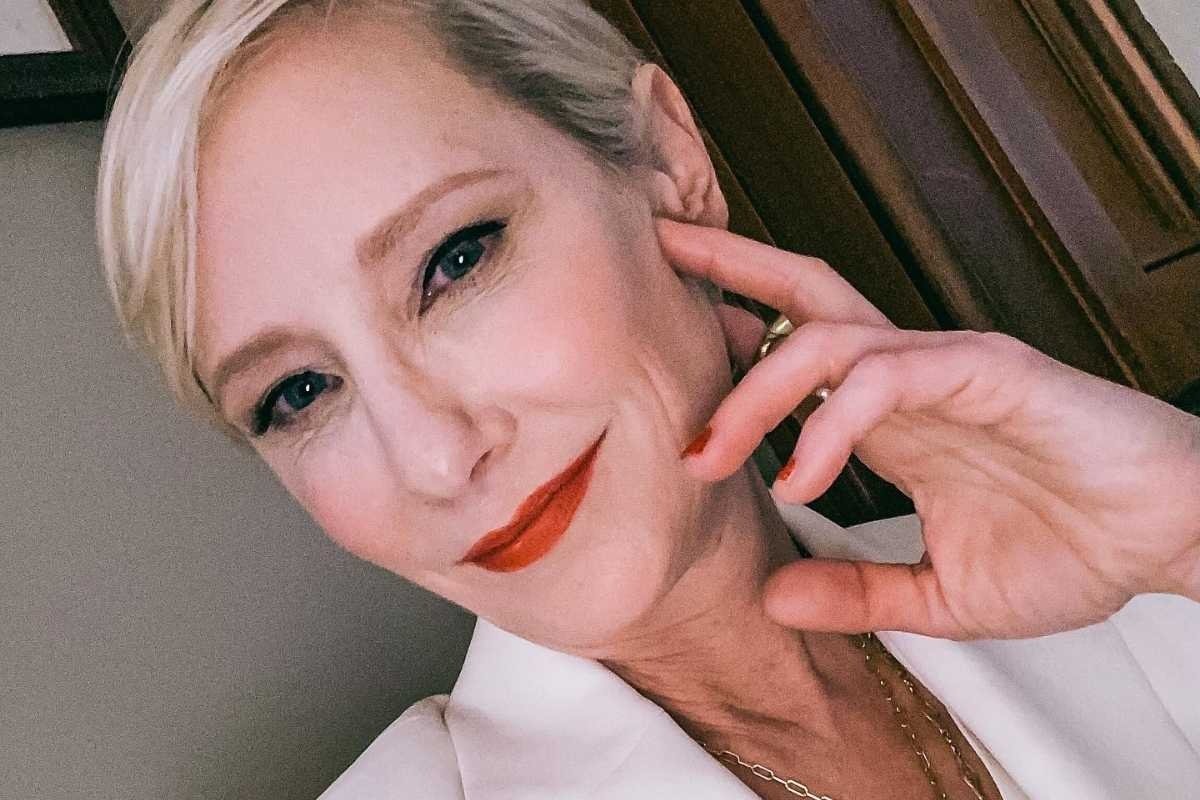 Anne Heche sofreu lesão cerebral após acidente, diz porta-voz