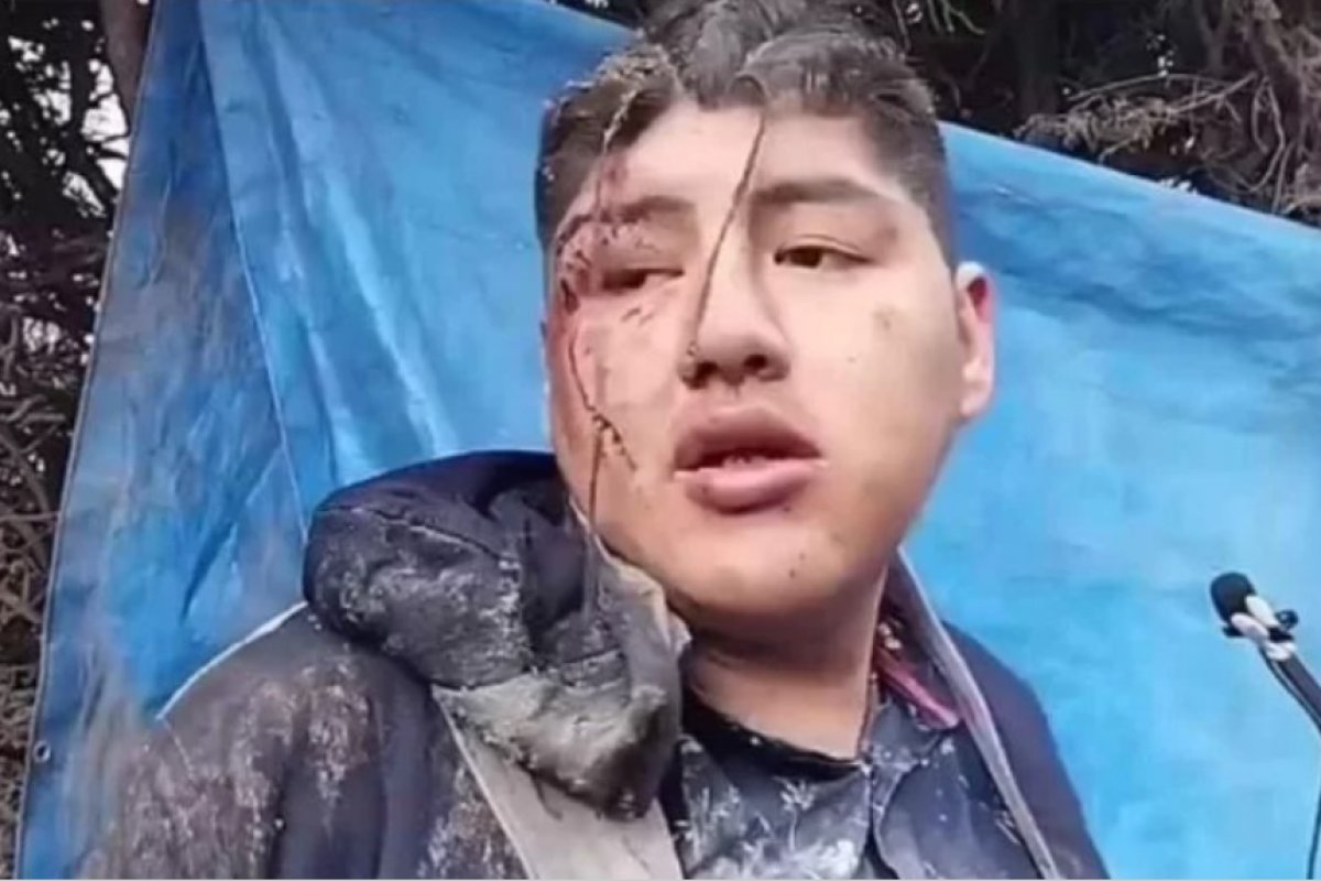 Na Bolívia, homem diz que foi oferecido como sacrifício humano e enterrado vivo