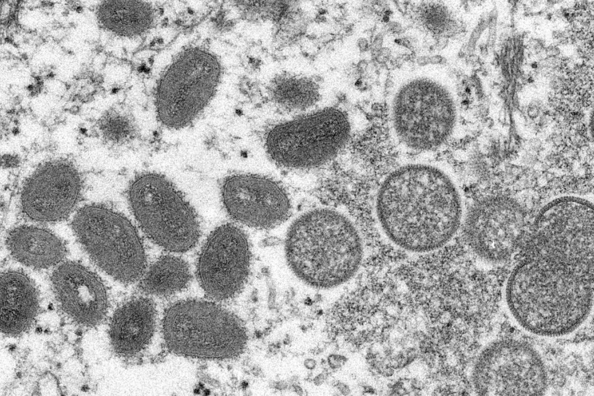 Bahia registra 39 casos da Monkeypox