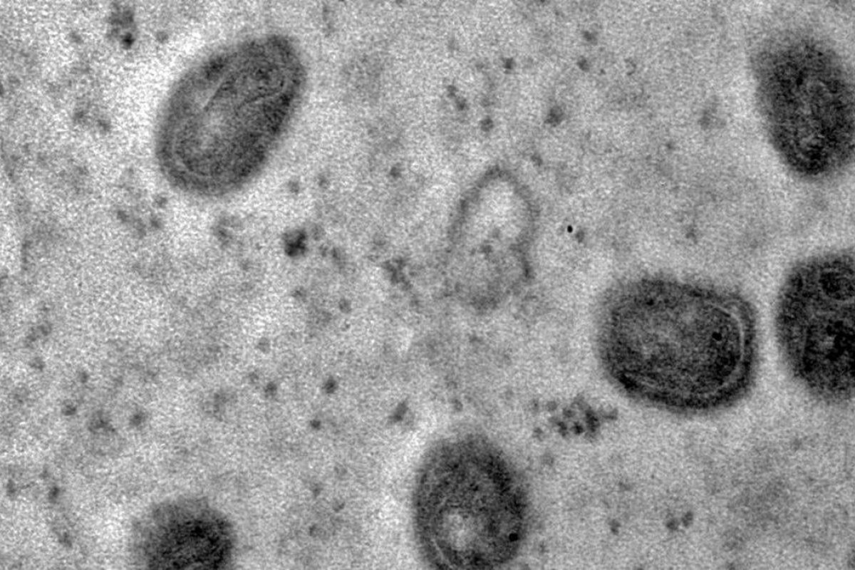 Fiocruz registra imagens de replicação do vírus monkeypox em célula