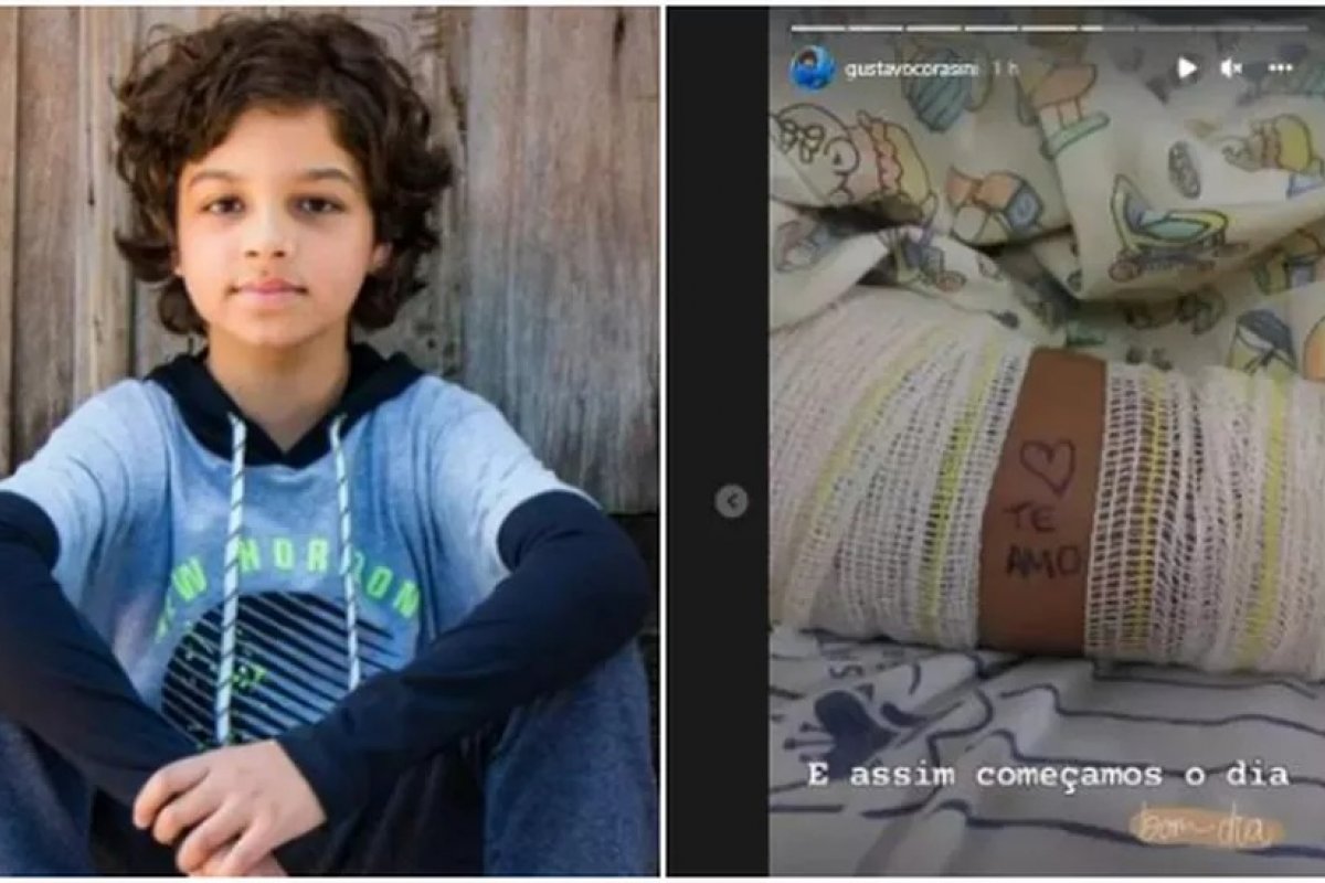 Gustavo Corasini, ator de 'Pantanal', passa por nova cirurgia no braço