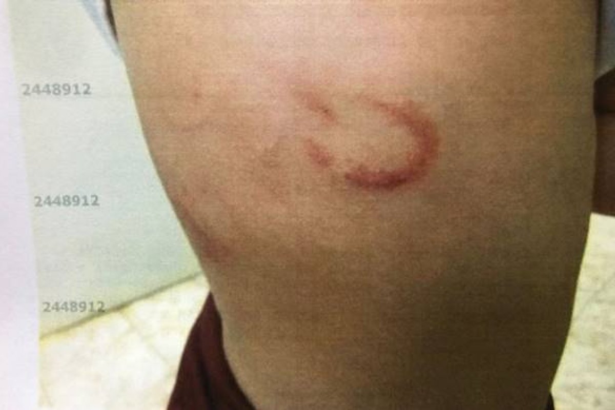 Mulher é presa por torturar filhos de 1 e 5 anos