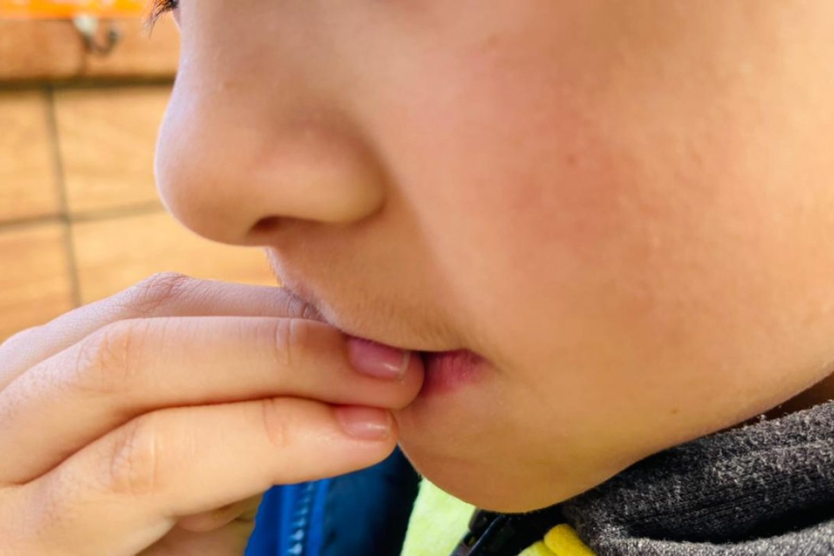 Crianças que roem unhas têm maior risco de déficit nas habilidades sociais!