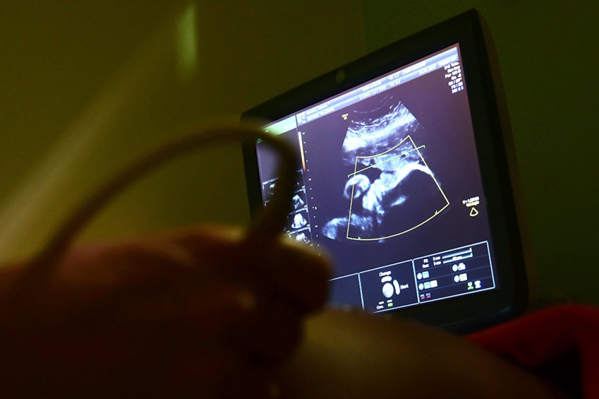 Estudo capta possíveis expressões faciais em fetos a partir do gosto de determinados alimentos