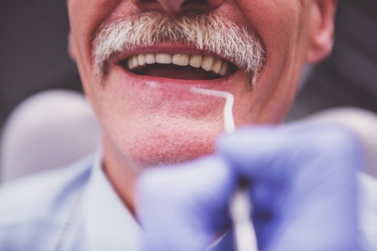 Perda de dentes aumenta em 28% riscos de demência!